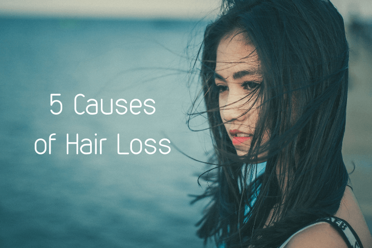 5 Causes of Hair Loss